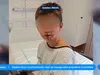 Frankrijk onderzoekt squishy die ontplofte in gezicht jongen (8)